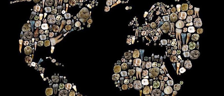 Mosaik einer Weltkarte aus diversen menschlichen Zähnen und Zahnüberresten