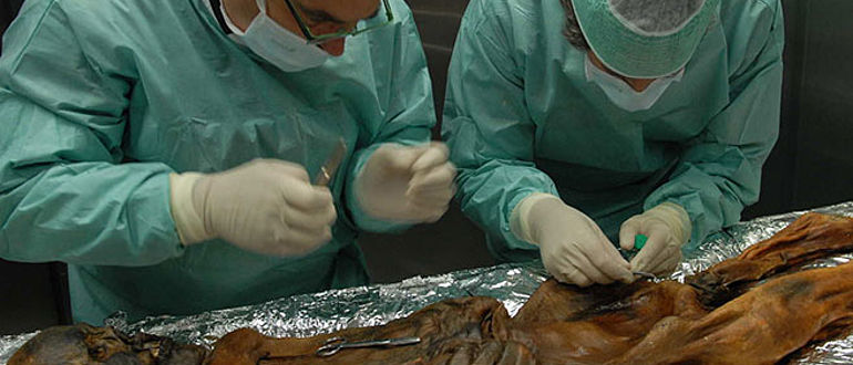 Progenentnahme Ötzi