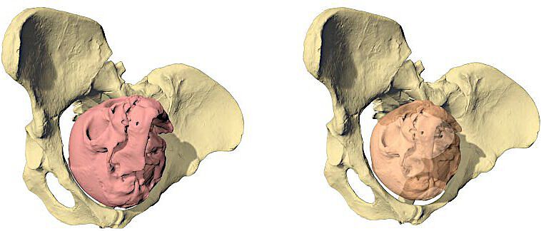 Geburtssimulation von Lucy (Australopithecus afarensis) mit drei unterschiedlich grossen Fetuskopfgrössen