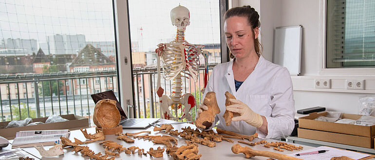 Knochenuntersuchung im Osteologie-Labor