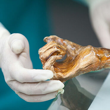 Ötzis Hand Ötzis Hand