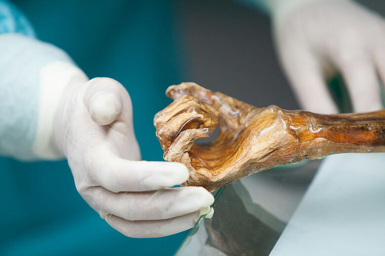 Ötzis Hand