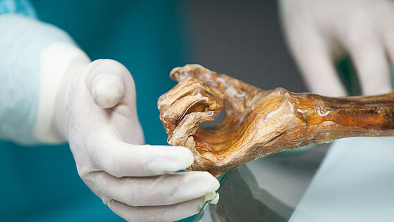 Ötzis Hand