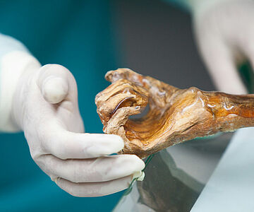 Ötzis Hand
