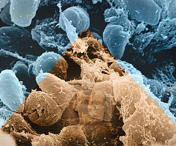 Pest aus Ägypten - Topos oder Tatsache?