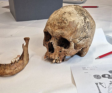 Schädel aus »Fürstengrab« von Emersleben