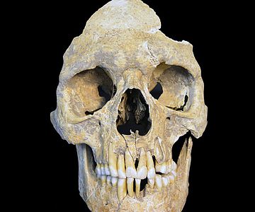Neolithischer Schädel aus Karsdorf mit Hepatitis-B-Infizierung