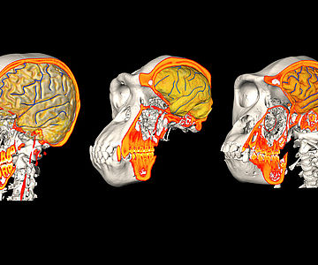 CT/MRI Mensch, Schimpanse, Gorilla