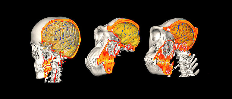 CT/MRI Mensch, Schimpanse, Gorilla