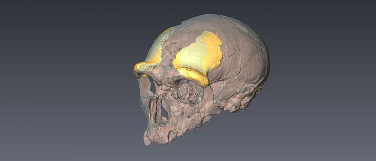 CT-Scan