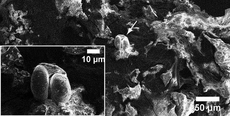 Mesolithische Nahrunsreste im Rasterelektronenmikroskop