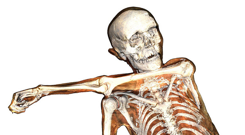 CT-Scan und Photogrammetrie der Eismumie Ötzi