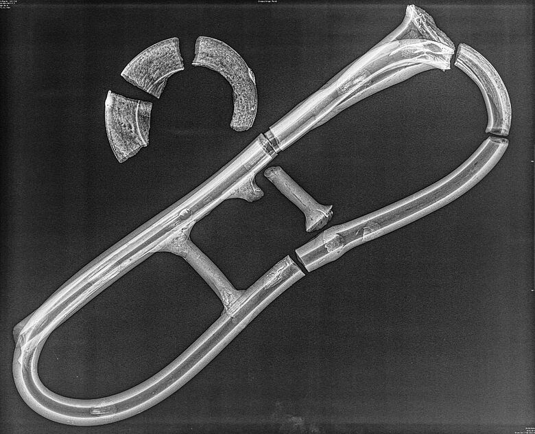 Röntgenaufnahme der Trompete