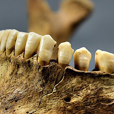 Feine Linien im Zahnschmelz zeigen Stressphasen im Leben der frühmittelalterlichen Menschen an