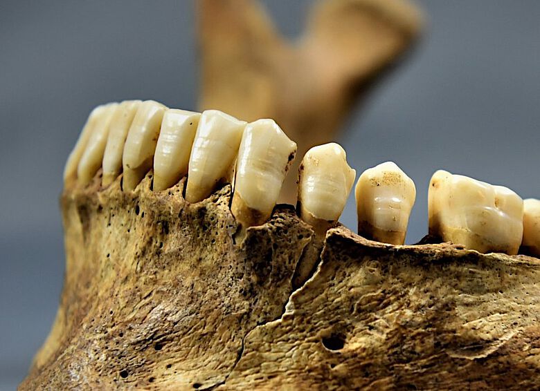 Feine Linien im Zahnschmelz zeigen Stressphasen im Leben der frühmittelalterlichen Menschen an