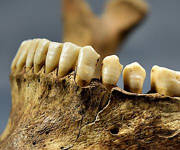 Feine Linien im Zahnschmelz zeigen Stressphasen im Leben der frühmittelalterlichen Menschen an