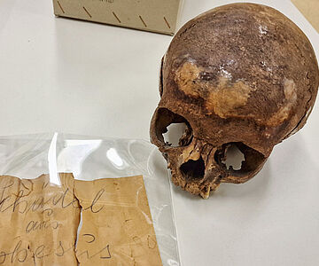 Der Schädel aus dem Oktogon von Ephesos in der Sammlung des Instituts für Evolutionäre Anthropologie der Universität Wien