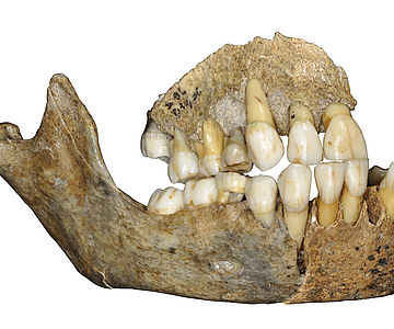Kieferknochen eines Neanderthalermädchens