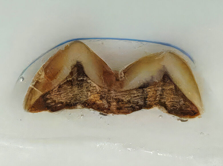 Dünnschliff eines Homo erectus Zahns