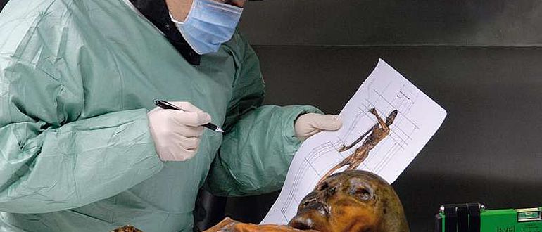 Untersuchung der Gletschermumie