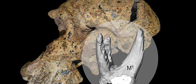 Schädel des Paranthropus robustus SK 46, Zahnrekonstruktion