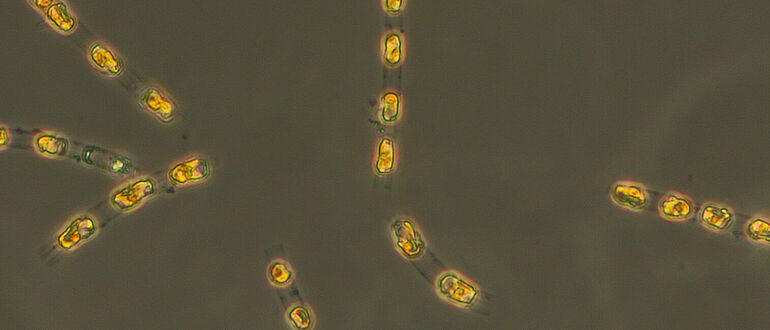 Kieselalge Skeletonema marinoi