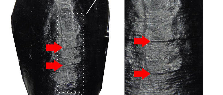 Defekte in Zahnschmelzentwicklung Neandertaler