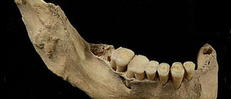 Unterkiefer des 40 000 Jahre alten menschlichen Skeletts aus der Tianyuan-Höhle: Analysen des Knochenkollagens zeigen, dass dieser Mensch regelmäßig Fisch konsumiert hat. (Hong Shang / Chinesische Akademie der Wissenschaften, Peking)