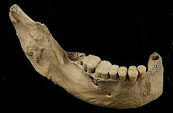 Unterkiefer des 40 000 Jahre alten menschlichen Skeletts aus der Tianyuan-Höhle: Analysen des Knochenkollagens zeigen, dass dieser Mensch regelmäßig Fisch konsumiert hat. (Hong Shang / Chinesische Akademie der Wissenschaften, Peking)