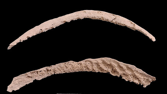 Knochen mit Syphilis-ähnlichem Erregergenom