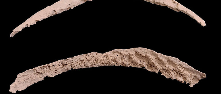 Knochen mit Syphilis-ähnlichem Erregergenom