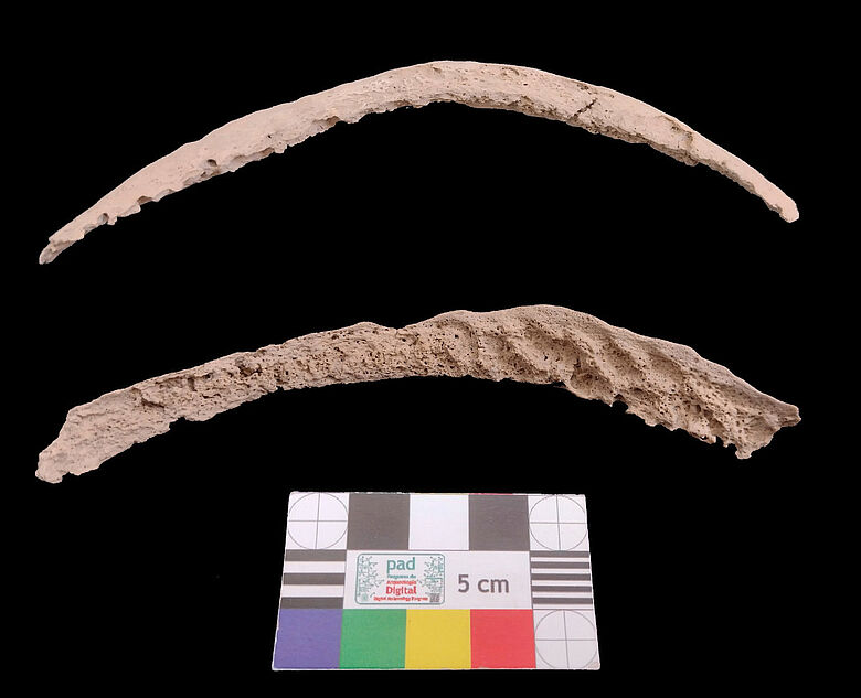 Knochen mit Syphilis-ähnlichem Erregergenom