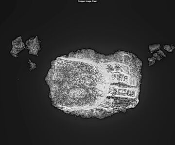 Das Röntgenbild zeigt, wo die Finger aus Metall an der Prothese angesetzt sind