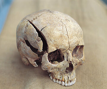 Gespaltener Schädel