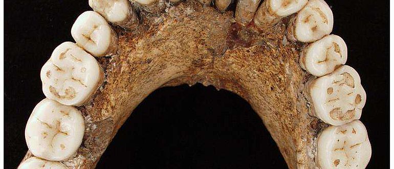 Gut erhaltener Unterkiefer des Neandertalers Regourdou 1 (© P. Sémal, Royal Belgian Institute of Natural Sciences Brussels)