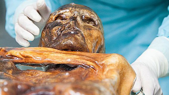 Untersuchungen an Ötzi, dem Mann aus dem Eis 