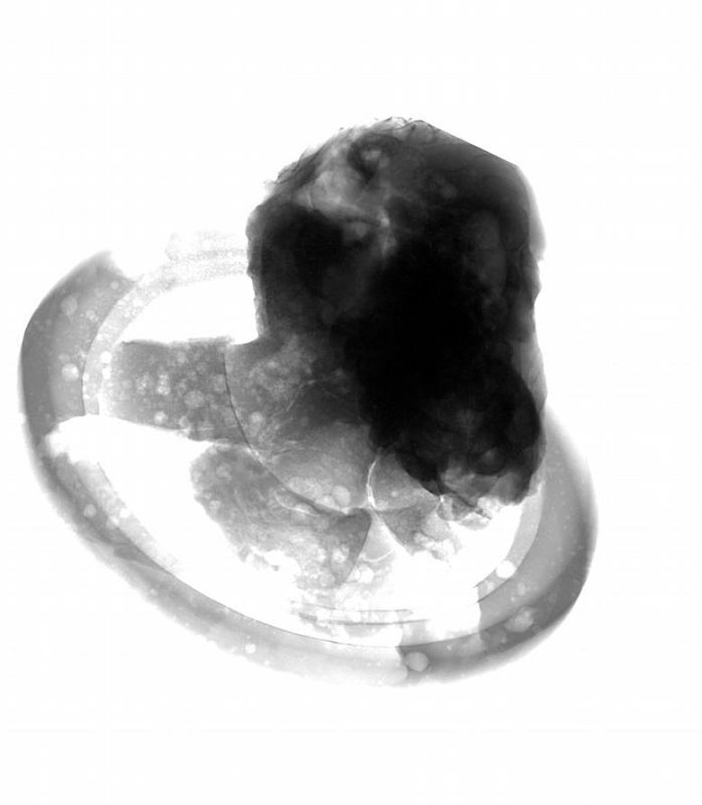 Radiografie eines Prophetenkopfes von der Florenzer Paradiespforte. Oben links im Kopf ist ein Loch (weiß) sichtbar, das erst später wieder aufgefüllt wurde. (Foto: Martin Mühlbauer / TU München)