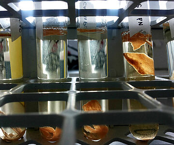 Knochenproben in Säure