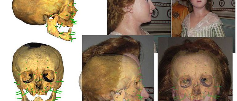 Gesichtsrekonstruktion mit eingeblendetem Schädel