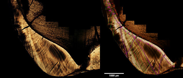 Mikroskop-Bild Orang-Utan-Zahn (Dünnschliff)