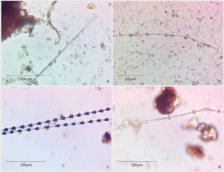 Mikroskopaufnahmen der Federfragmente von Bad Dürrenberg