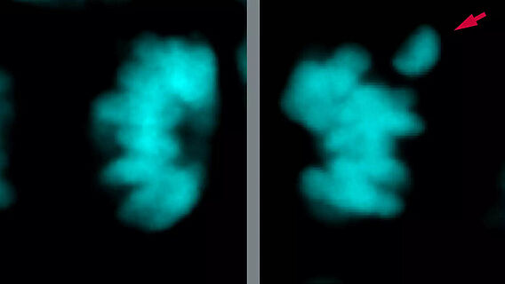 Chromosomen einer neuronalen Stammzelle