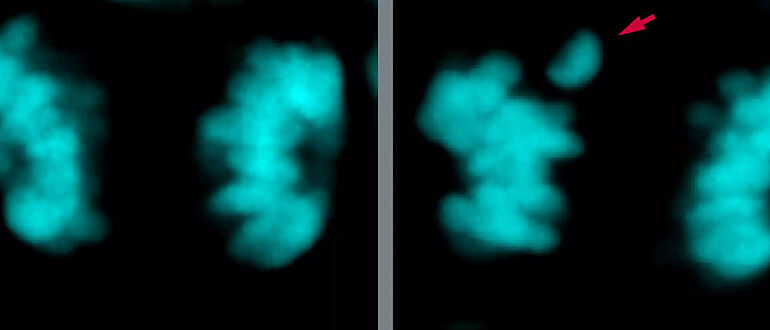 Chromosomen einer neuronalen Stammzelle