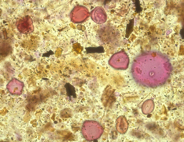 Pollenprobe aus den Sedimenten des Hüttilersees Pollenprobe aus den Sedimenten des Hüttilersees
